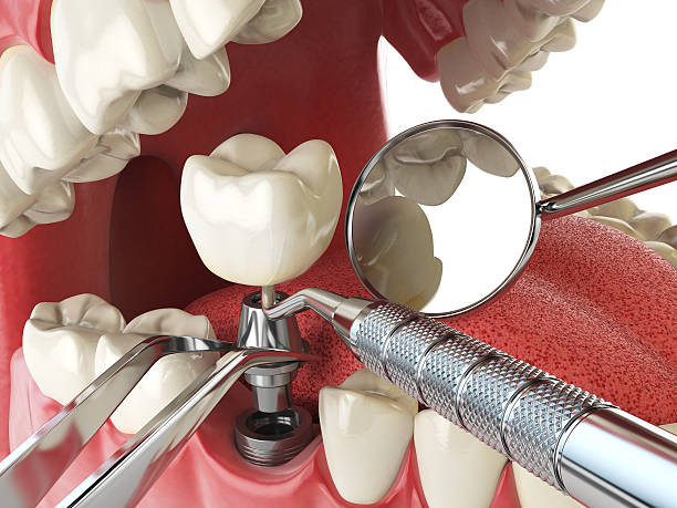 Best Pediatric Emergency Dentist in Winona, MS